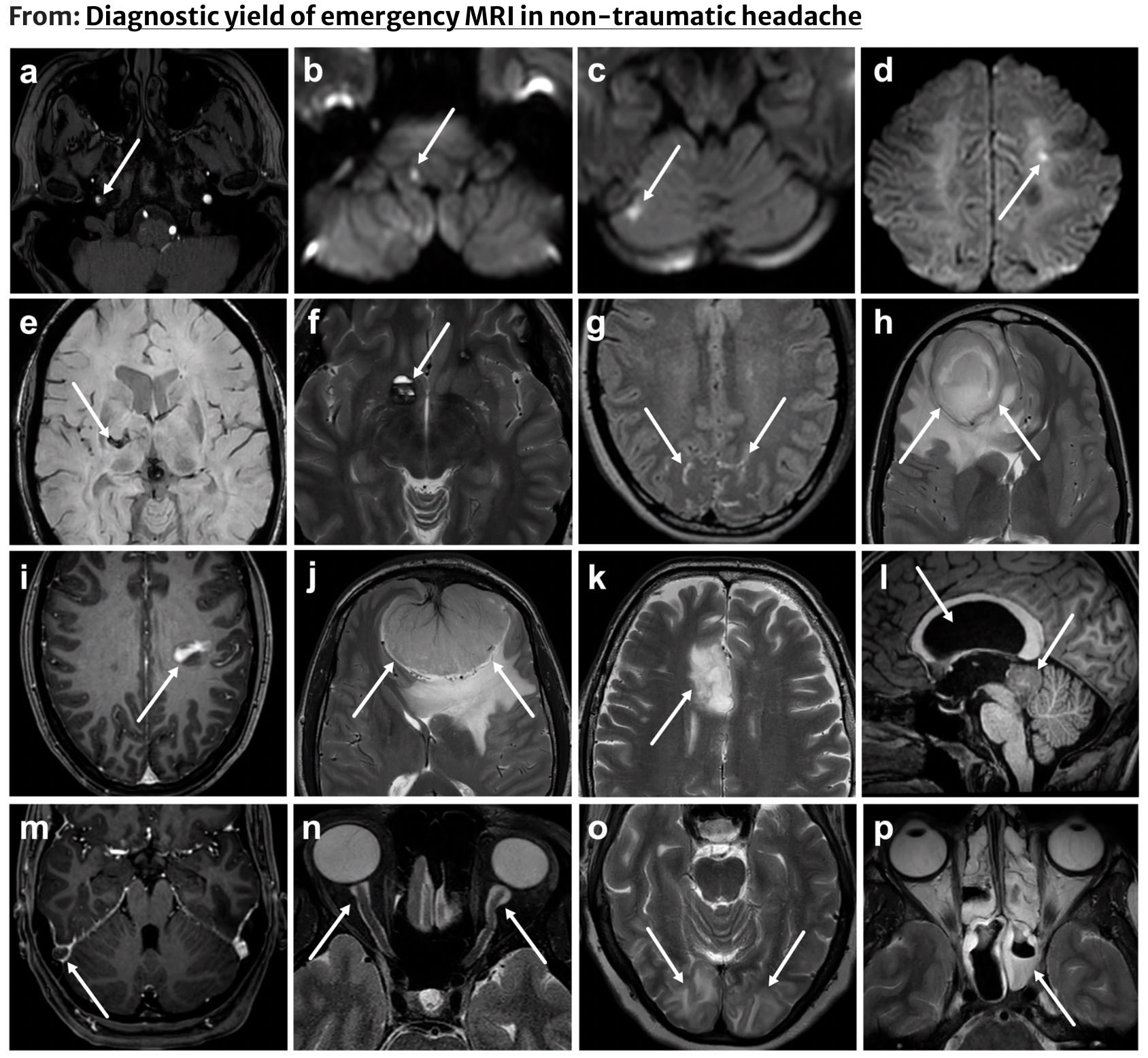 Neuroradiology Research