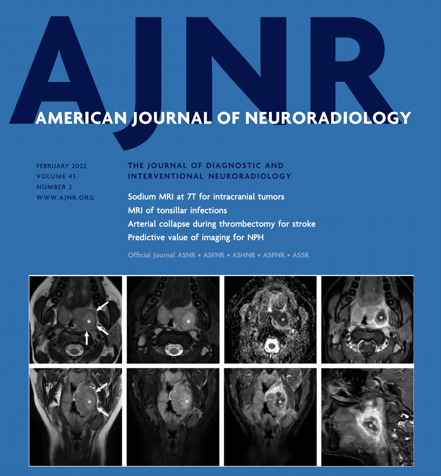 Head and Neck Infection Research